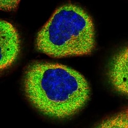 SMG7 Antibody, Novus Biologicals 0.1mL; Unlabeled:Antibodies, Polyclonal